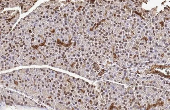 METTL14 Antibody in Immunohistochemistry (Paraffin) (IHC (P))