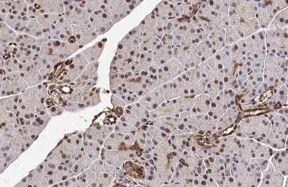 METTL14 Antibody in Immunohistochemistry (Paraffin) (IHC (P))