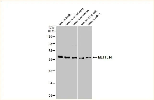 METTL14 Antibody in Western Blot (WB)