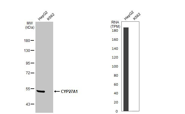 CYP27A1 Antibody in Western Blot (WB)