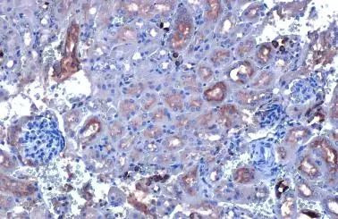 CYP27A1 Antibody in Immunohistochemistry (Paraffin) (IHC (P))