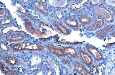 CYP27A1 Antibody in Immunohistochemistry (Paraffin) (IHC (P))