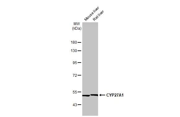 CYP27A1 Antibody in Western Blot (WB)