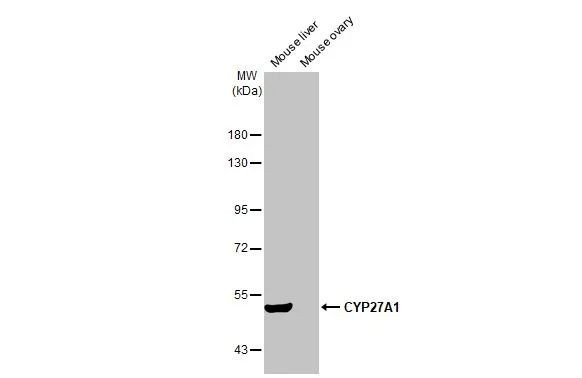 CYP27A1 Antibody in Western Blot (WB)