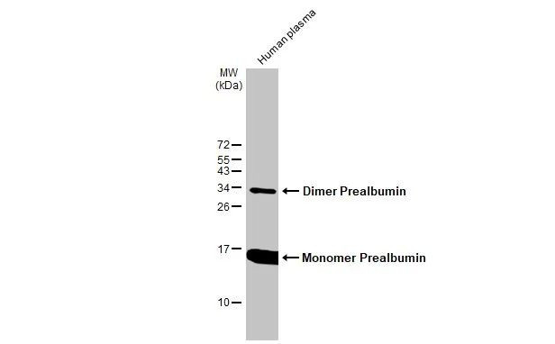 Transthyretin Antibody in Western Blot (WB)