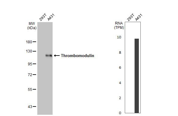 Thrombomodulin Antibody in Western Blot (WB)