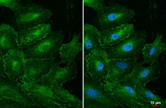 MLKL Antibody in Immunocytochemistry (ICC/IF)