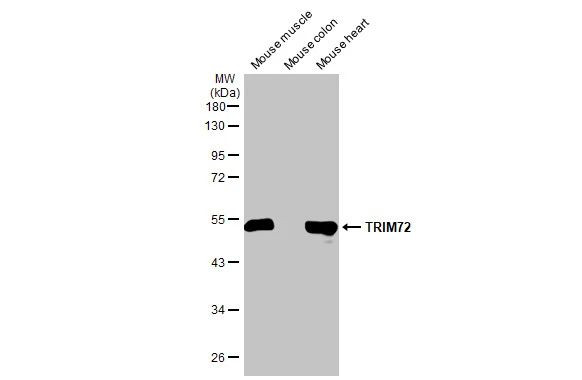 TRIM72 Antibody in Western Blot (WB)