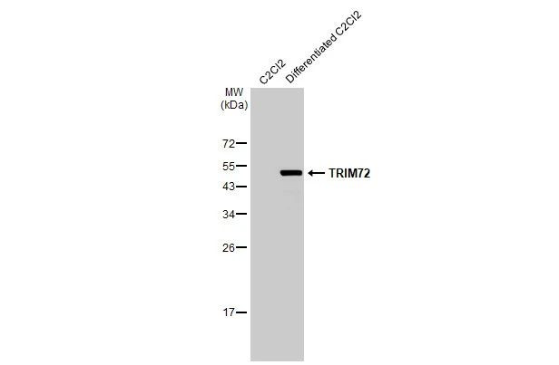 TRIM72 Antibody in Western Blot (WB)