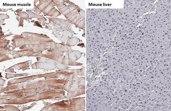 TRIM72 Antibody in Immunohistochemistry (Paraffin) (IHC (P))