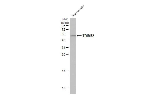 TRIM72 Antibody in Western Blot (WB)