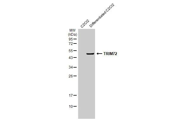 TRIM72 Antibody in Western Blot (WB)