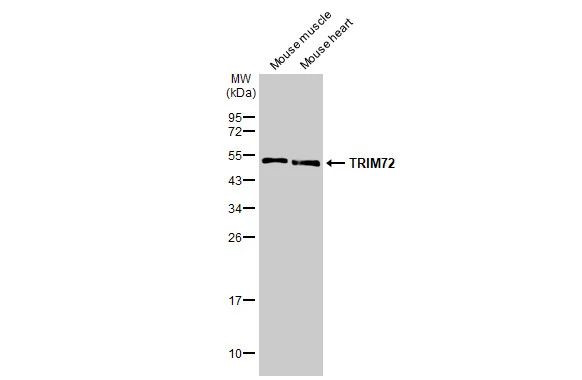 TRIM72 Antibody in Western Blot (WB)