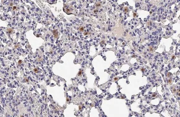 IL-18 Antibody in Immunohistochemistry (Paraffin) (IHC (P))