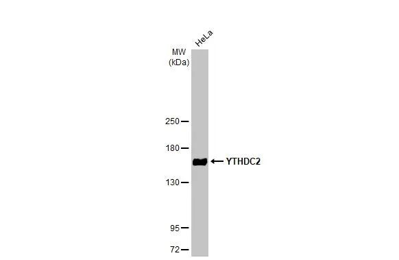 YTHDC2 Antibody in Western Blot (WB)