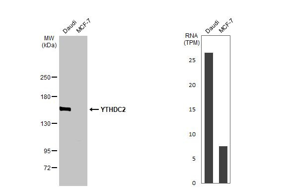 YTHDC2 Antibody in Western Blot (WB)