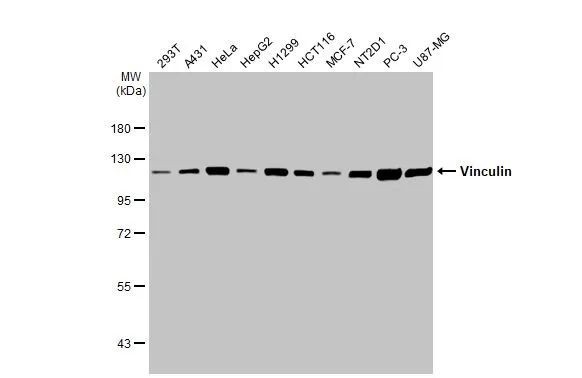 Vinculin Antibody in Western Blot (WB)