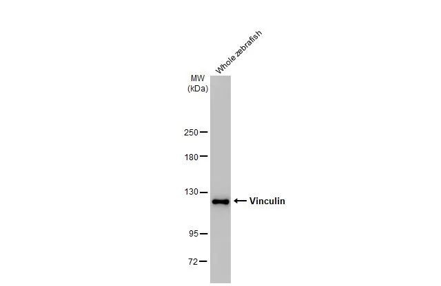 Vinculin Antibody in Western Blot (WB)