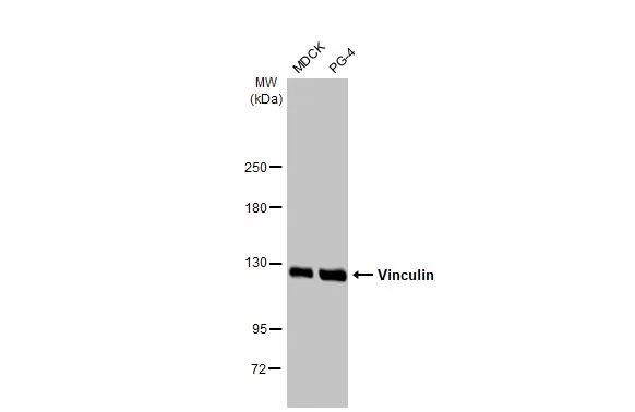 Vinculin Antibody in Western Blot (WB)