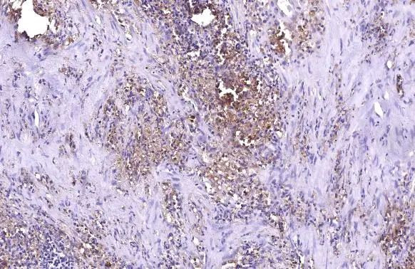 ZC3HAV1 Antibody in Immunohistochemistry (Paraffin) (IHC (P))