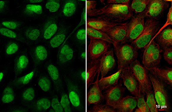 YAP1 Antibody in Immunocytochemistry (ICC/IF)