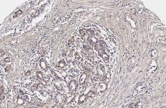 YAP1 Antibody in Immunohistochemistry (Paraffin) (IHC (P))