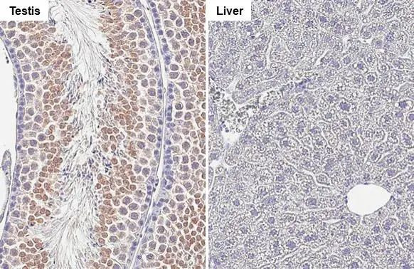 Collagen III Antibody in Immunohistochemistry (Paraffin) (IHC (P))