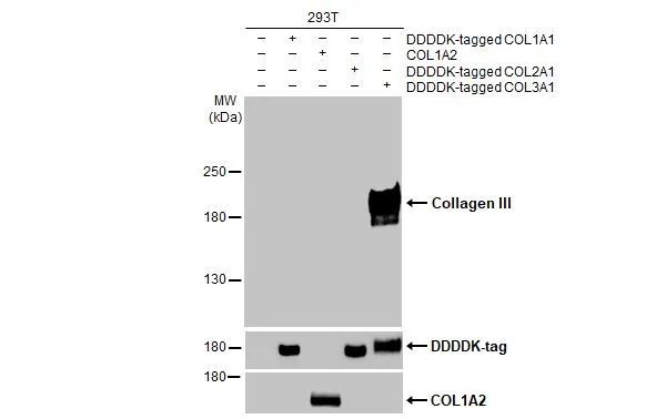 Collagen III Antibody in Western Blot (WB)