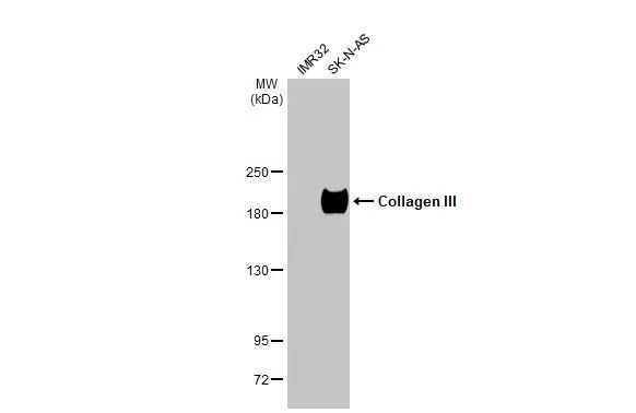 Collagen III Antibody in Western Blot (WB)