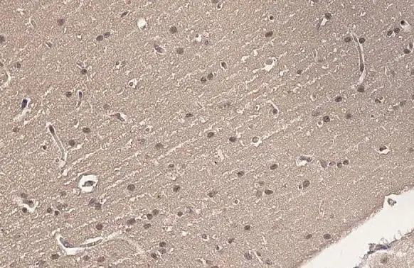 Ataxin 3 Antibody in Immunohistochemistry (Paraffin) (IHC (P))