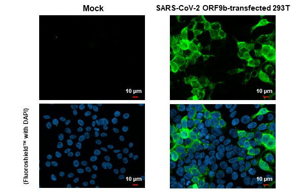 SARS-CoV-2 ORF9b Antibody in Immunocytochemistry (ICC/IF)