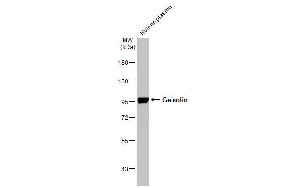 Gelsolin Antibody in Western Blot (WB)