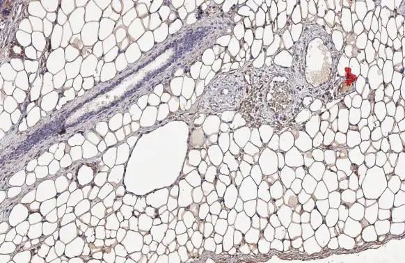 Monoacylglycerol Lipase Antibody in Immunohistochemistry (Paraffin) (IHC (P))