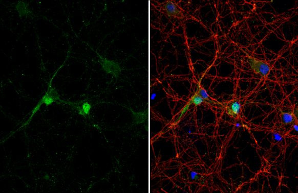 DLX2 Antibody in Immunocytochemistry (ICC/IF)