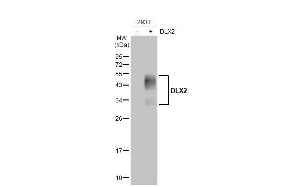 DLX2 Antibody in Western Blot (WB)