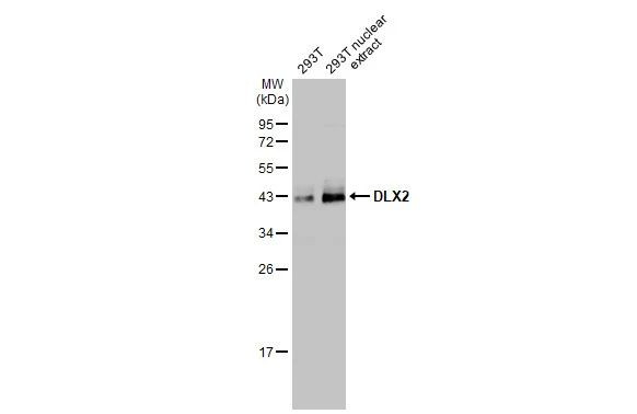 DLX2 Antibody in Western Blot (WB)