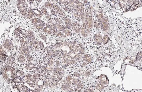 UNC84A Antibody in Immunohistochemistry (Paraffin) (IHC (P))