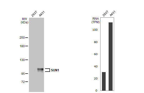 UNC84A Antibody in Western Blot (WB)