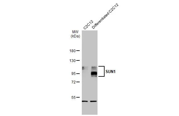 UNC84A Antibody in Western Blot (WB)