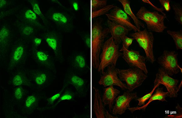 TCF3 Antibody in Immunocytochemistry (ICC/IF)