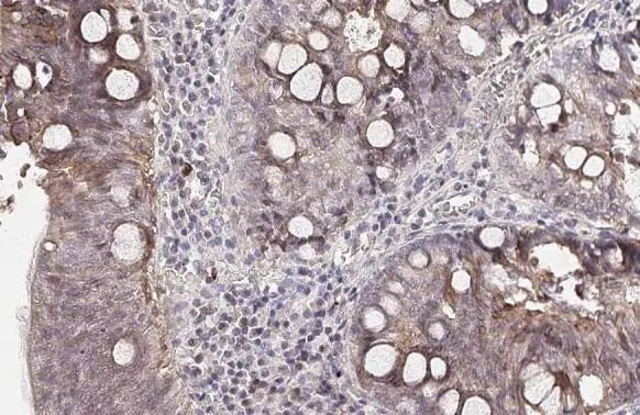 Apolipoprotein B Antibody in Immunohistochemistry (Paraffin) (IHC (P))