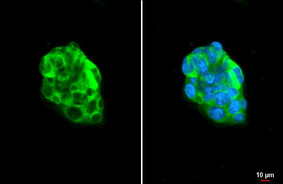 Apolipoprotein B Antibody in Immunocytochemistry (ICC/IF)