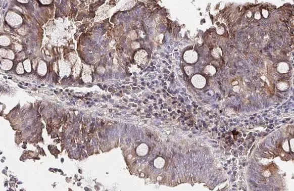 Apolipoprotein B Antibody in Immunohistochemistry (Paraffin) (IHC (P))