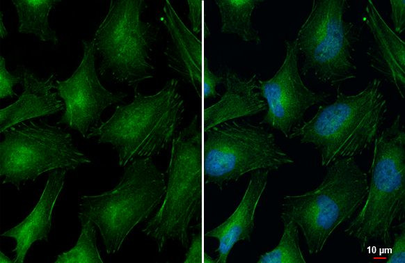 Vinculin Antibody in Immunocytochemistry (ICC/IF)