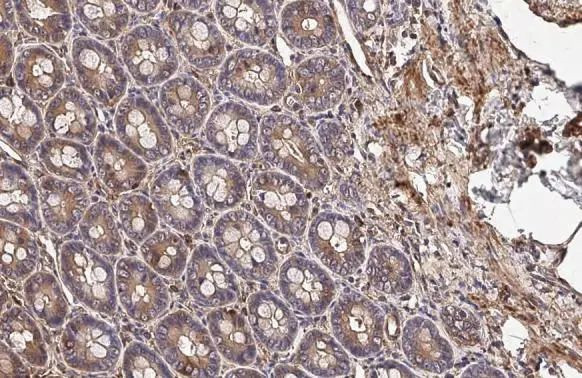 Vinculin Antibody in Immunohistochemistry (Paraffin) (IHC (P))