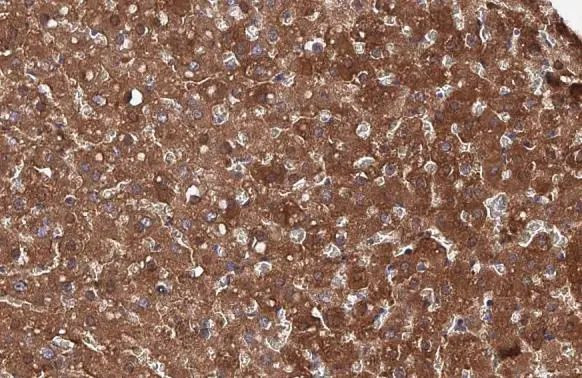 FAH Antibody in Immunohistochemistry (Paraffin) (IHC (P))