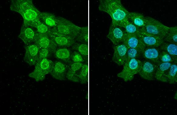 ELAVL2 Antibody in Immunocytochemistry (ICC/IF)