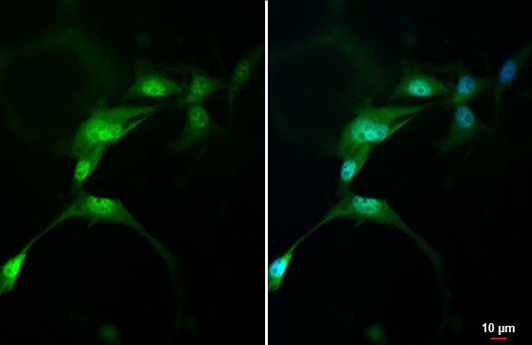 AHR Antibody in Immunocytochemistry (ICC/IF)