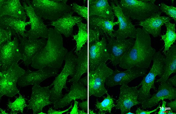 ASCT2 Antibody in Immunocytochemistry (ICC/IF)