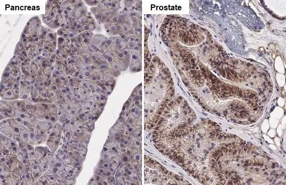 ASCT2 Antibody in Immunohistochemistry (Paraffin) (IHC (P))